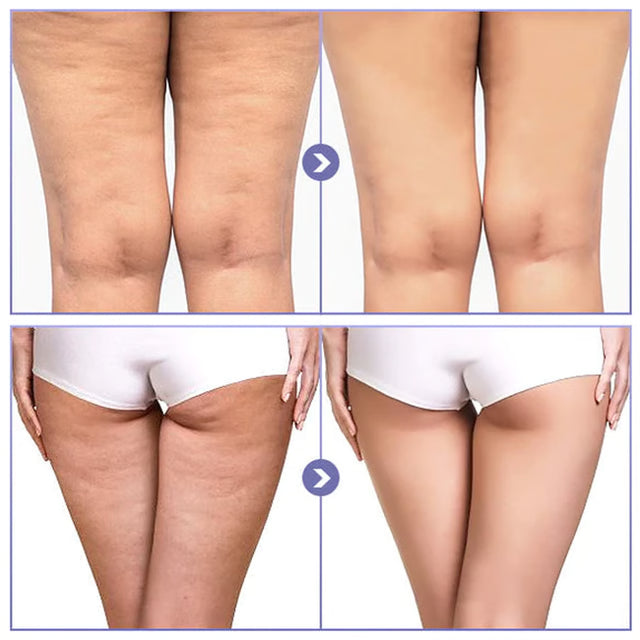 Thigh Anti Wear Patch, Invisible Thin Leg Stickers, Ultra Thin Inner Sticker for Foot Care