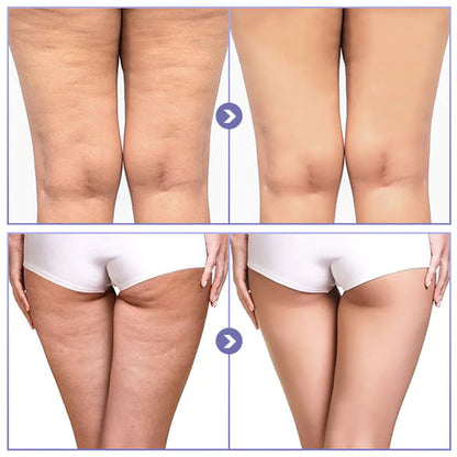 Thigh Anti Wear Patch, Invisible Thin Leg Stickers, Ultra Thin Inner Sticker for Foot Care