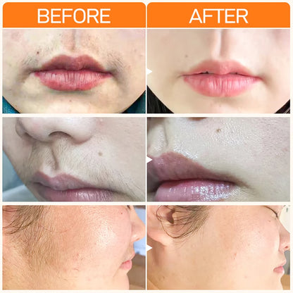 Fast Gentle Hair Removal Cream for Women, Whitening & Skin Care Depilation for Clear Lips and Underarms